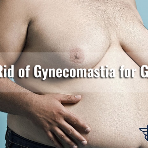 Get Rid of Gynecomastia